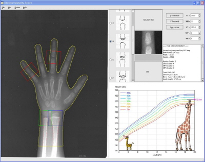 New software predicts 'how tall my child will be' image